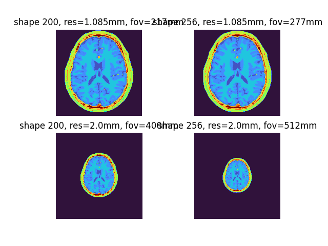 shape 200, res=1.085mm, fov=217mm, shape 256, res=1.085mm, fov=277mm, shape 200, res=2.0mm, fov=400mm, shape 256, res=2.0mm, fov=512mm