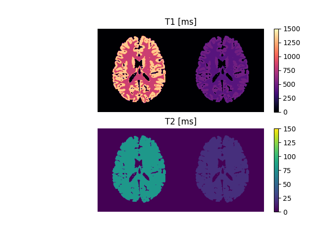 T1 [ms], T2 [ms]