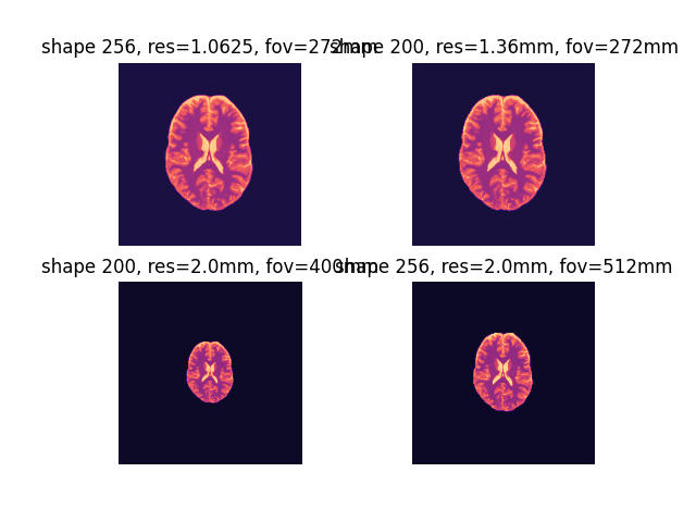 shape 256, res=1.0625, fov=272mm, shape 200, res=1.36mm, fov=272mm, shape 200, res=2.0mm, fov=400mm, shape 256, res=2.0mm, fov=512mm