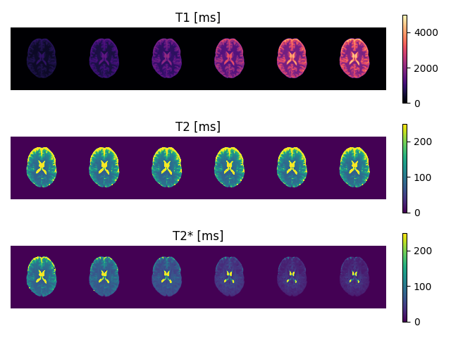 T1 [ms], T2 [ms], T2* [ms]