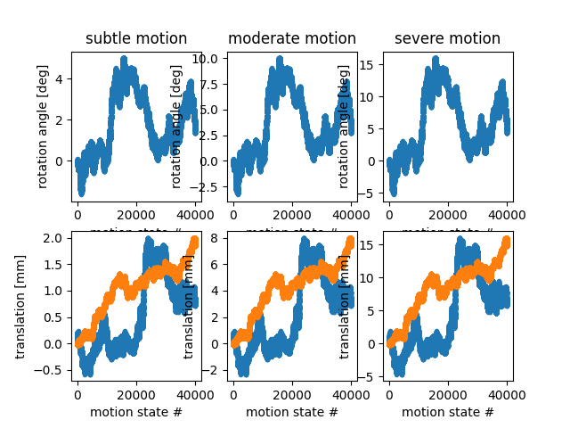 subtle motion, moderate motion, severe motion