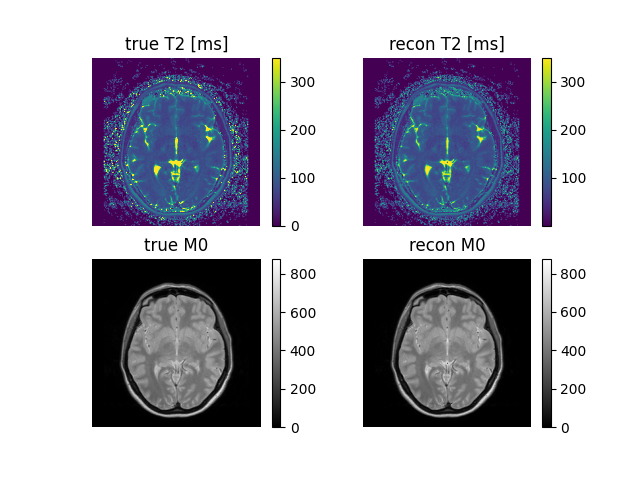 true T2 [ms], recon T2 [ms], true M0, recon M0